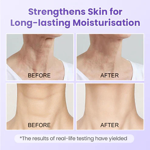 Adesivo antirrugas para pescoço com peptídeos