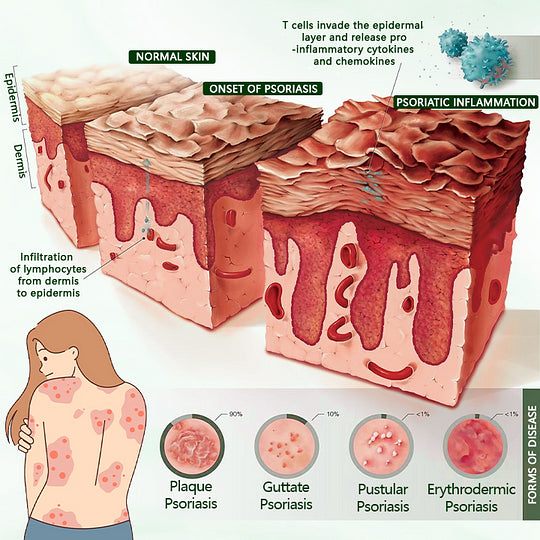 Timilk® 🥬Creme cicatrizante DermaPure com óleo de melaleuca