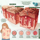 Timilk® 🥬Creme cicatrizante DermaPure com óleo de melaleuca