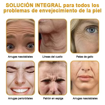 🍀ÚLTIMO DIA 80% DE DESCONTO✨Creme antirrugas Furezero™ Botox com veneno de abelha 🐝