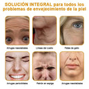 🍀ÚLTIMO DIA 80% DE DESCONTO✨Creme antirrugas Furezero™ Botox com veneno de abelha 🐝