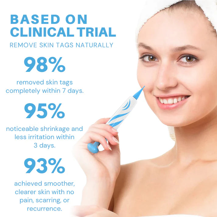 Caneta removedora de marcas de pele sem dor Fivfivgo® para uso doméstico