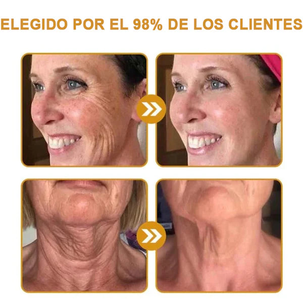 🍀ÚLTIMO DIA 80% DE DESCONTO✨Creme antirrugas Furezero™ Botox com veneno de abelha 🐝