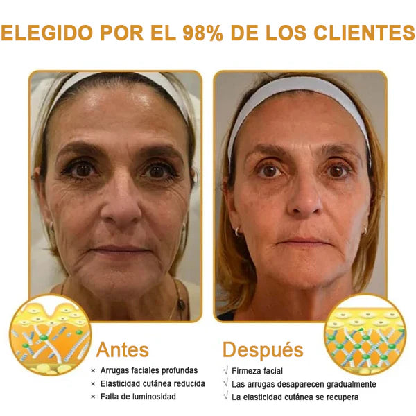 🍀ÚLTIMO DIA 80% DE DESCONTO✨Creme antirrugas Furezero™ Botox com veneno de abelha 🐝