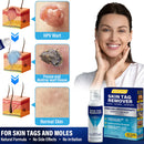 Spray de tratamento criogênico