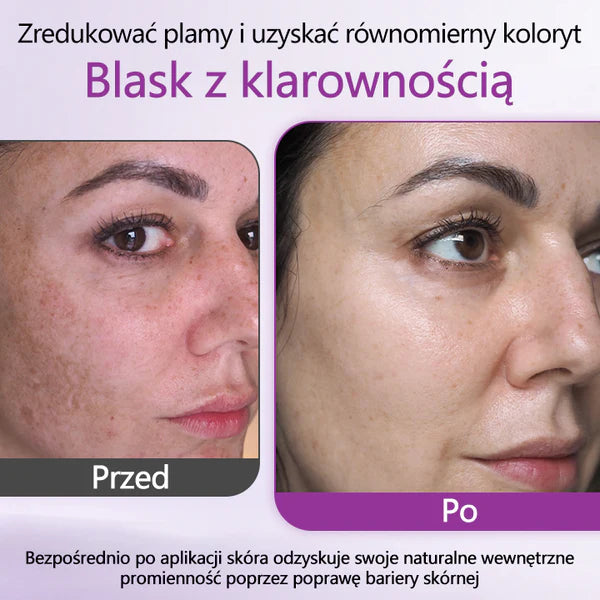 Essência Anti-Descoloração Avançada Ceoerty® MelantraX