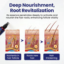 Sérum de Crescimento Capilar de Ação Rápida com 5% de Minoxidil de Força Máxima