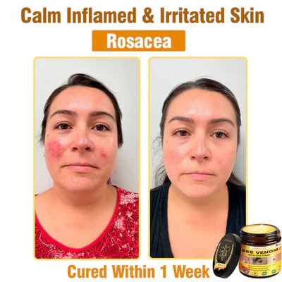 𝐁𝐞𝐞 𝐕𝐞𝐧𝐨𝐦 𝐀𝐥𝐥-𝐢𝐧-𝐎𝐧𝐞 𝐂𝐫𝐞𝐚𝐦