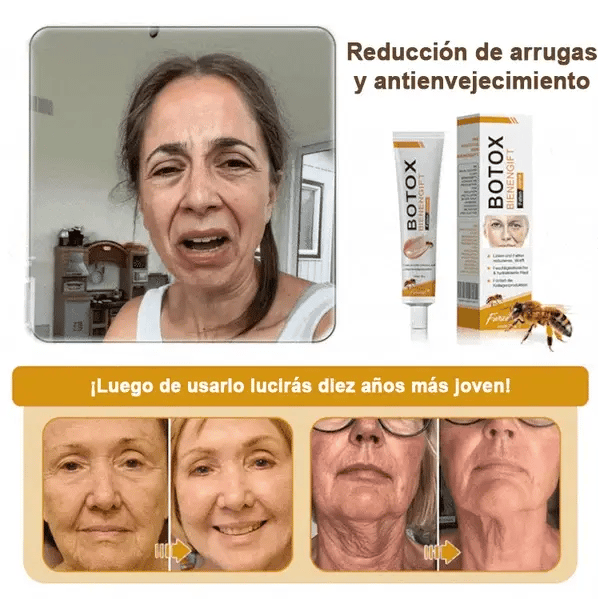 🍀ÚLTIMO DIA 80% DE DESCONTO✨Creme antirrugas Furezero™ Botox com veneno de abelha 🐝