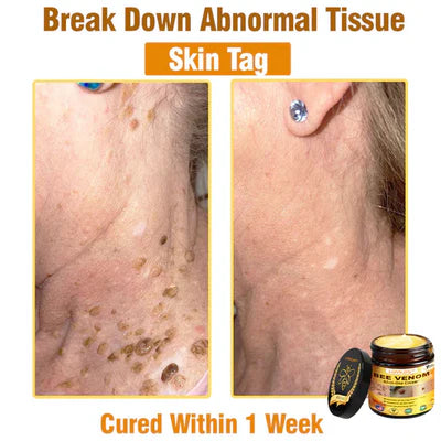 𝐁𝐞𝐞 𝐕𝐞𝐧𝐨𝐦 𝐀𝐥𝐥-𝐢𝐧-𝐎𝐧𝐞 𝐂𝐫𝐞𝐚𝐦