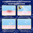 Spray de tratamento criogênico para verrugas cutâneas