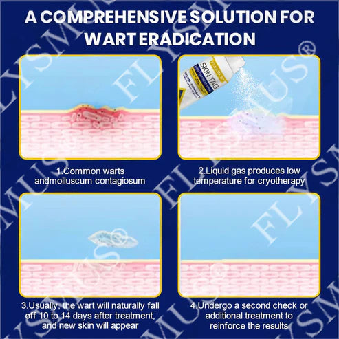 Spray de tratamento criogênico para verrugas cutâneas