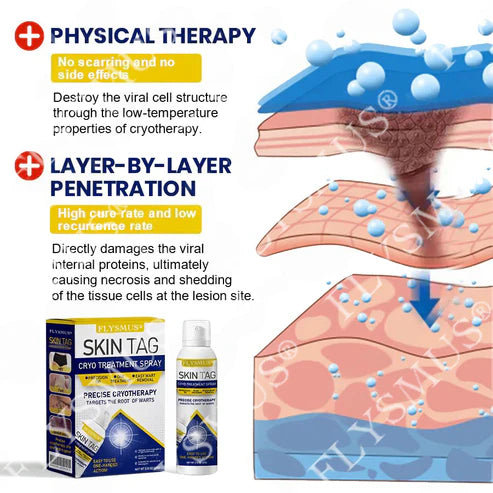 Spray de tratamento criogênico para verrugas cutâneas