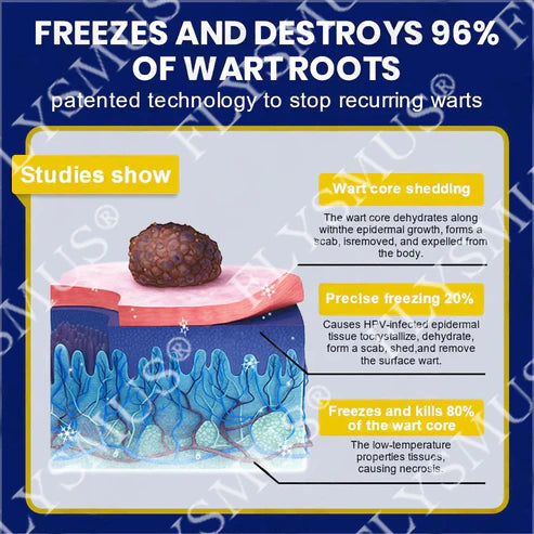 Spray de tratamento criogênico para verrugas cutâneas