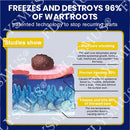 Spray de tratamento criogênico para verrugas cutâneas