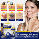 Spray de tratamento criogênico para verrugas cutâneas