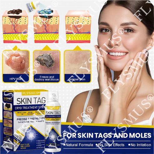 Spray de tratamento criogênico para verrugas cutâneas