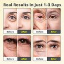 Sérum Retinoplastia Vita A