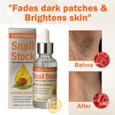 Sérum facial de correção de melanina