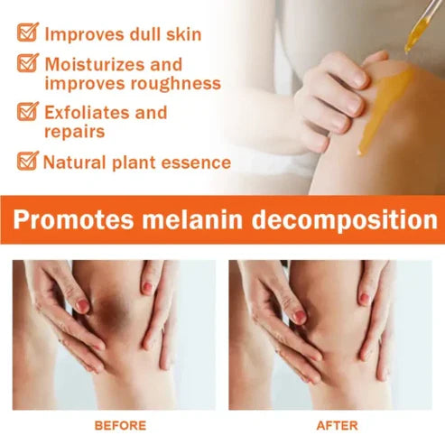 Sérum facial de correção de melanina
