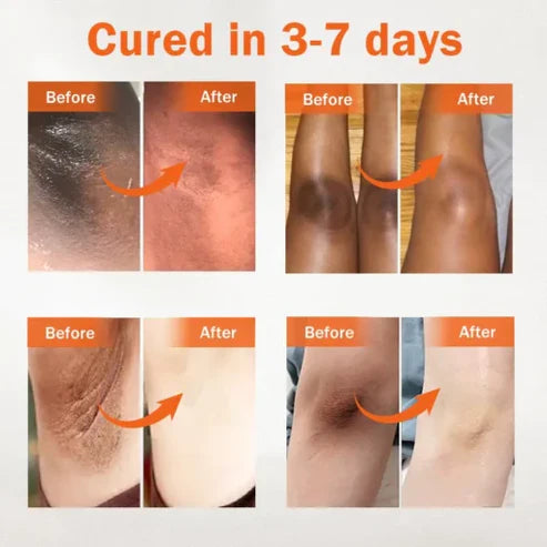 Sérum facial de correção de melanina