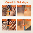 Sérum facial de correção de melanina