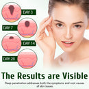 Timilk® 🥬Creme cicatrizante DermaPure com óleo de melaleuca