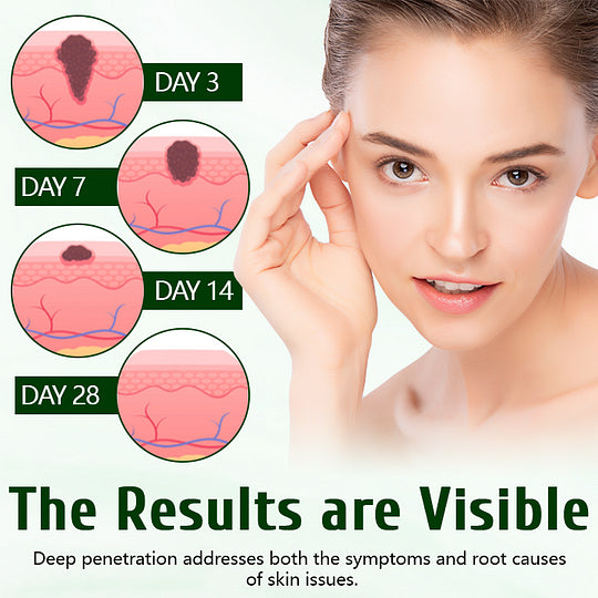 Timilk® 🥬Creme cicatrizante DermaPure com óleo de melaleuca